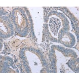 Immunohistochemistry - TNFRSF25 Antibody from Signalway Antibody (35717) - Antibodies.com