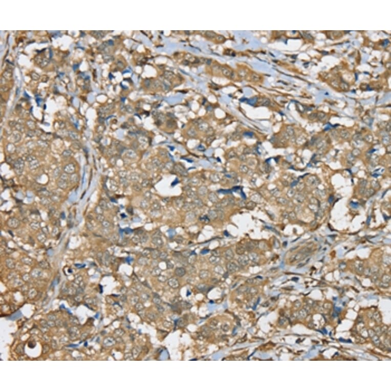 Immunohistochemistry - SERPINA11 Antibody from Signalway Antibody (37915) - Antibodies.com