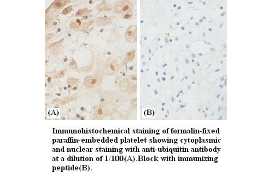 ubiquitin Antibody from Signalway Antibody (39382) - Antibodies.com
