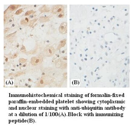 ubiquitin Antibody from Signalway Antibody (39382) - Antibodies.com