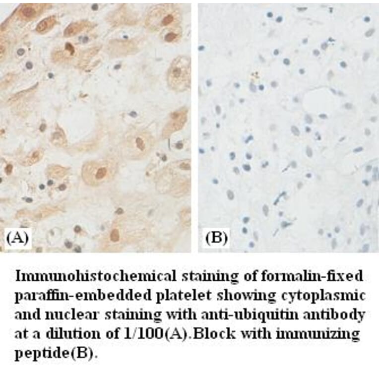 ubiquitin Antibody from Signalway Antibody (39382) - Antibodies.com