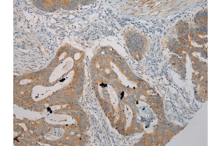 Immunohistochemistry - SERPINA12 Antibody from Signalway Antibody (40100) - Antibodies.com