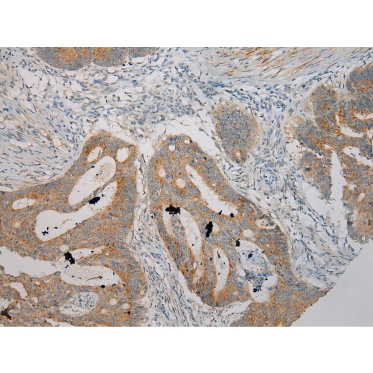 Immunohistochemistry - SERPINA12 Antibody from Signalway Antibody (40100) - Antibodies.com