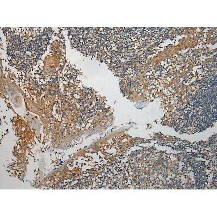 Immunohistochemistry - TMPRSS11E Antibody from Signalway Antibody (40160) - Antibodies.com