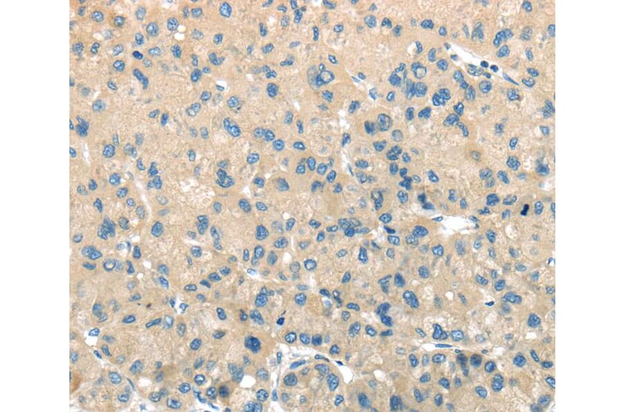 Immunohistochemistry - TMPRSS11A Antibody from Signalway Antibody (40161) - Antibodies.com