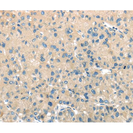 Immunohistochemistry - TMPRSS11A Antibody from Signalway Antibody (40161) - Antibodies.com