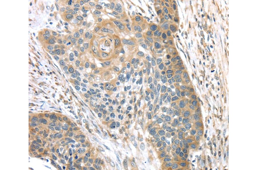 Immunohistochemistry - TMPRSS11A Antibody from Signalway Antibody (40161) - Antibodies.com