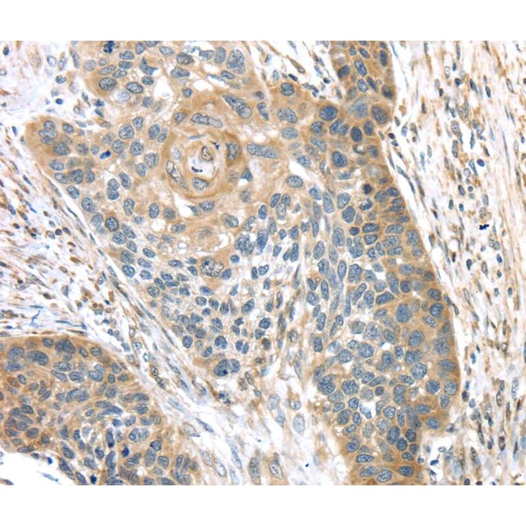 Immunohistochemistry - TMPRSS11A Antibody from Signalway Antibody (40161) - Antibodies.com