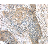 Immunohistochemistry - TMPRSS11A Antibody from Signalway Antibody (40161) - Antibodies.com