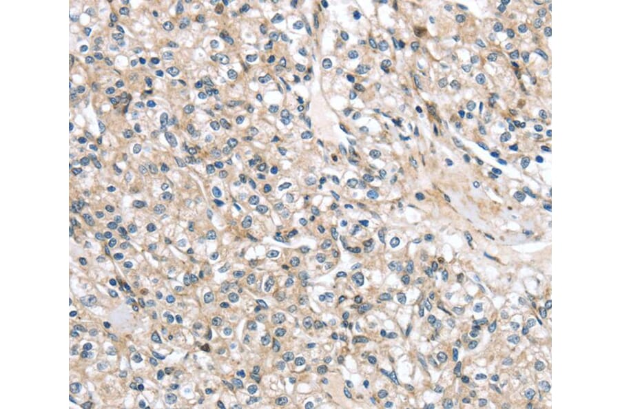 Immunohistochemistry - TMPRSS11B Antibody from Signalway Antibody (40162) - Antibodies.com