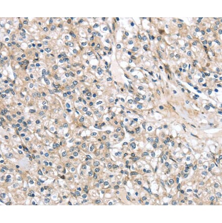 Immunohistochemistry - TMPRSS11B Antibody from Signalway Antibody (40162) - Antibodies.com