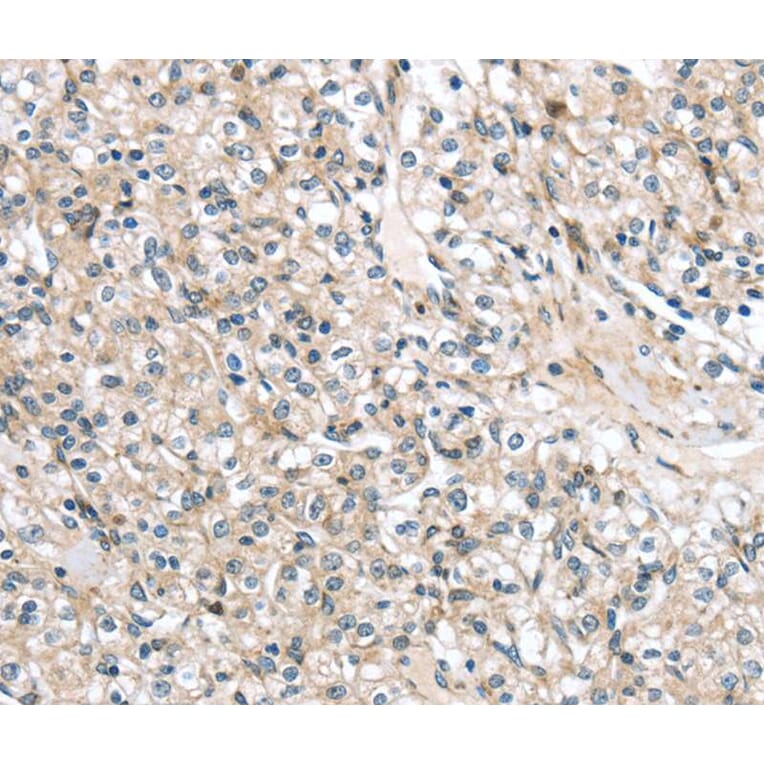 Immunohistochemistry - TMPRSS11B Antibody from Signalway Antibody (40162) - Antibodies.com