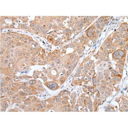 TNFRSF10A Antibody from Signalway Antibody (43656) - Antibodies.com