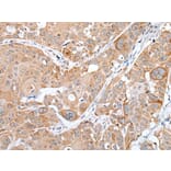 TNFRSF10A Antibody from Signalway Antibody (43656) - Antibodies.com