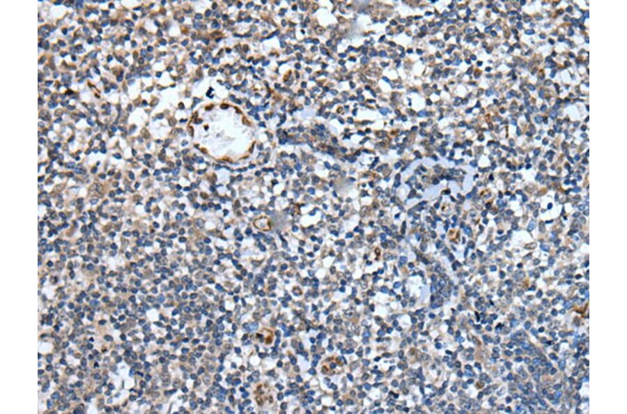 PAPPA-AS1 Antibody from Signalway Antibody (43780) - Antibodies.com