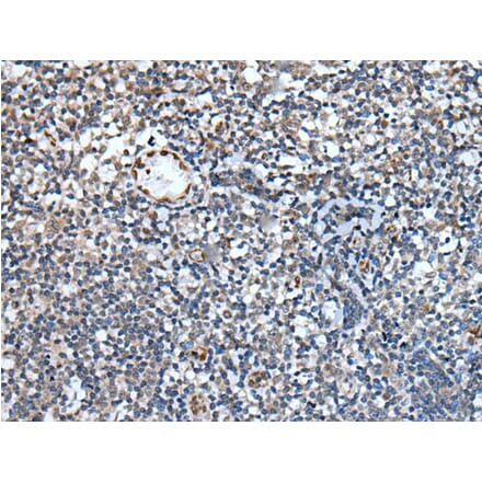 PAPPA-AS1 Antibody from Signalway Antibody (43780) - Antibodies.com