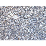 PAPPA-AS1 Antibody from Signalway Antibody (43780) - Antibodies.com