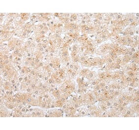 KRTAP11-1 Antibody from Signalway Antibody (43919) - Antibodies.com