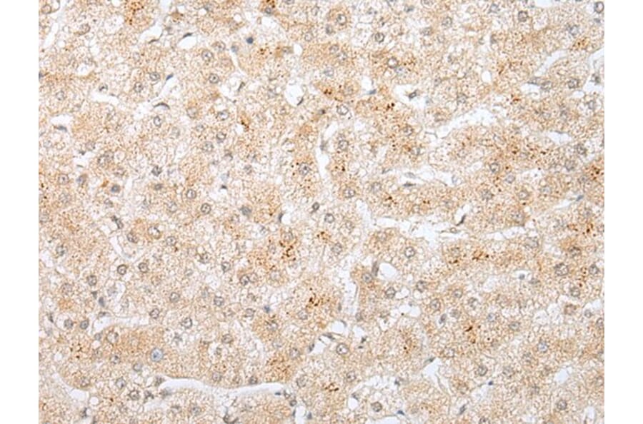 KRTAP11-1 Antibody from Signalway Antibody (43919) - Antibodies.com