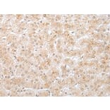 KRTAP11-1 Antibody from Signalway Antibody (43919) - Antibodies.com