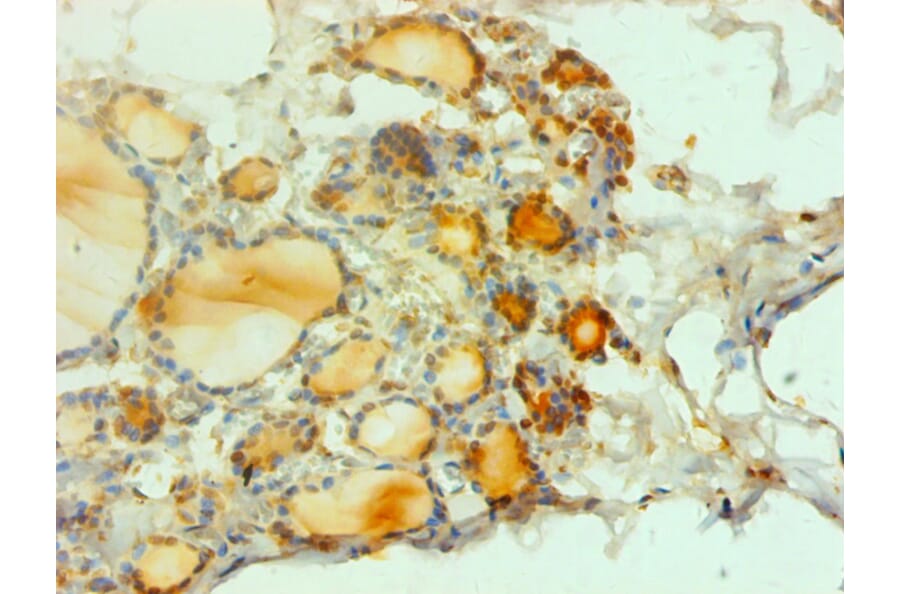 Immunohistochemistry - proCalcitonin£¨PCT£© Monoclonal Antibody from Signalway Antibody (42046) - Antibodies.com