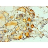 Immunohistochemistry - proCalcitonin£¨PCT£© Monoclonal Antibody from Signalway Antibody (42046) - Antibodies.com