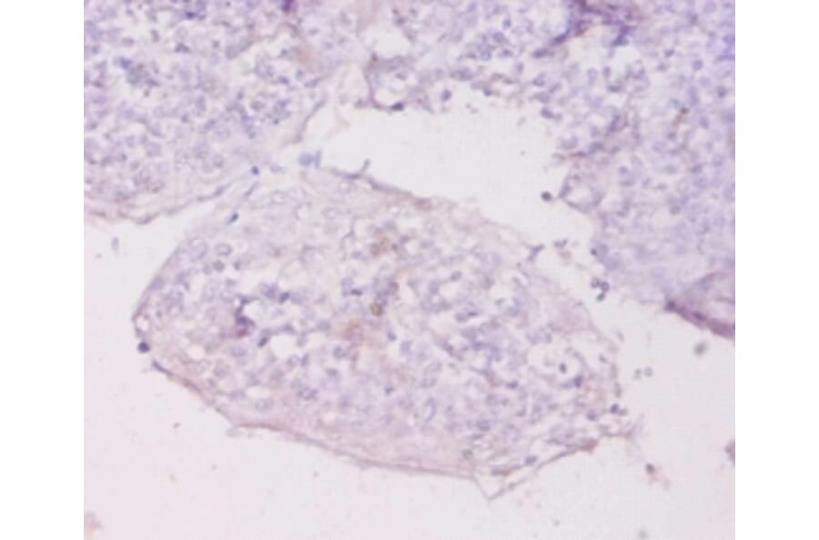 Immunohistochemistry - Metallothionein-1E Polyclonal Antibody from Signalway Antibody (42612) - Antibodies.com