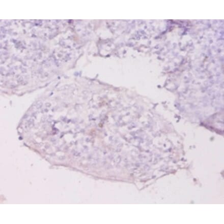 Immunohistochemistry - Metallothionein-1E Polyclonal Antibody from Signalway Antibody (42612) - Antibodies.com