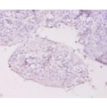 Immunohistochemistry - Metallothionein-1E Polyclonal Antibody from Signalway Antibody (42612) - Antibodies.com