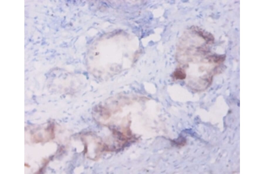 Immunohistochemistry - Metallothionein-1A Polyclonal Antibody from Signalway Antibody (42613) - Antibodies.com