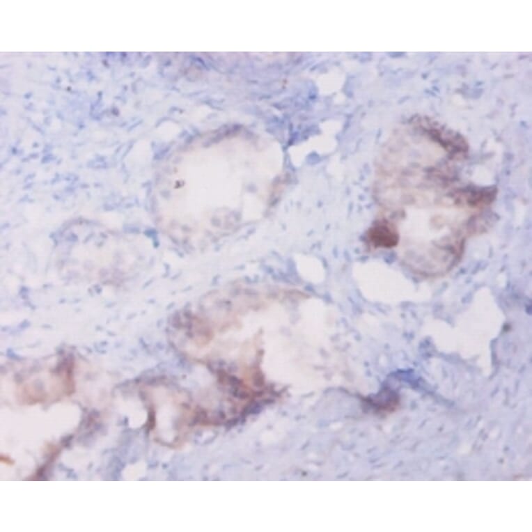 Immunohistochemistry - Metallothionein-1A Polyclonal Antibody from Signalway Antibody (42613) - Antibodies.com