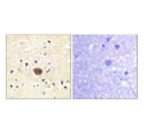 Immunohistochemistry - Ras-GRF1 Antibody from Signalway Antibody (33147) - Antibodies.com