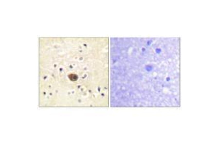 Immunohistochemistry - Ras-GRF1 Antibody from Signalway Antibody (33147) - Antibodies.com