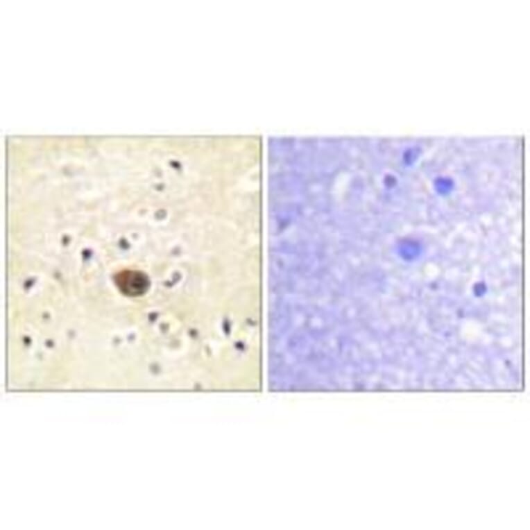 Immunohistochemistry - Ras-GRF1 Antibody from Signalway Antibody (33147) - Antibodies.com