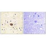 Immunohistochemistry - Ras-GRF1 Antibody from Signalway Antibody (33147) - Antibodies.com