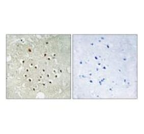 Immunohistochemistry - RPS19BP1 Antibody from Signalway Antibody (34333) - Antibodies.com