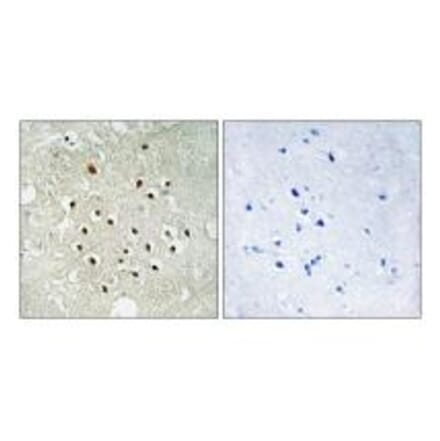 Immunohistochemistry - RPS19BP1 Antibody from Signalway Antibody (34333) - Antibodies.com