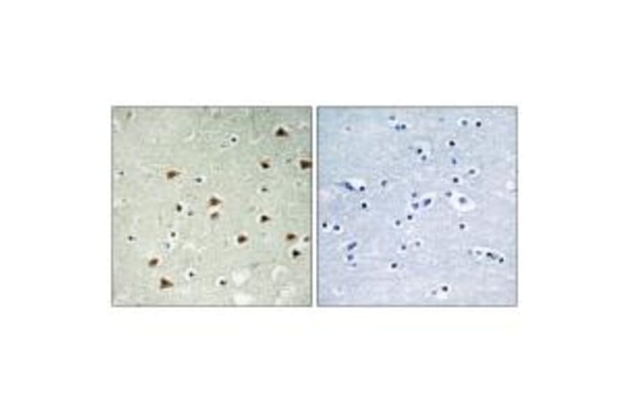 Immunohistochemistry - ABHD14B Antibody from Signalway Antibody (34369) - Antibodies.com