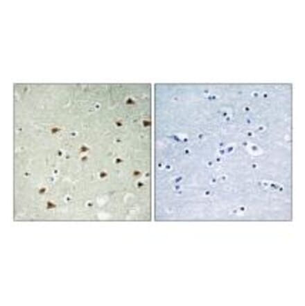 Immunohistochemistry - ABHD14B Antibody from Signalway Antibody (34369) - Antibodies.com