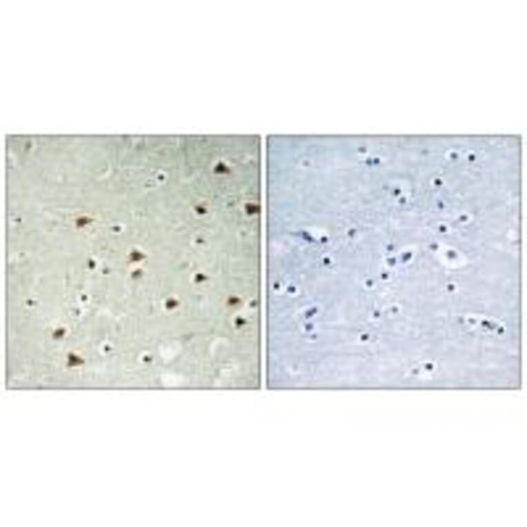 Immunohistochemistry - ABHD14B Antibody from Signalway Antibody (34369) - Antibodies.com