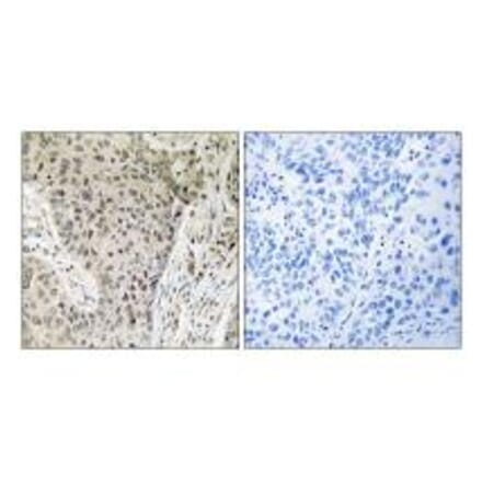 Immunohistochemistry - ARHGEF19 Antibody from Signalway Antibody (34994) - Antibodies.com