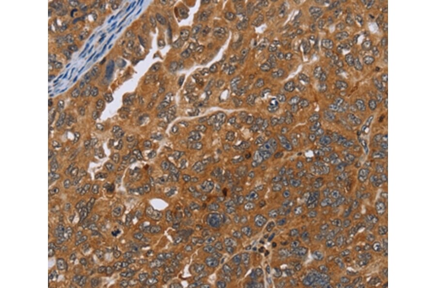 Immunohistochemistry - ADAMTS15 Antibody from Signalway Antibody (35644) - Antibodies.com