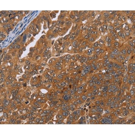 Immunohistochemistry - ADAMTS15 Antibody from Signalway Antibody (35644) - Antibodies.com