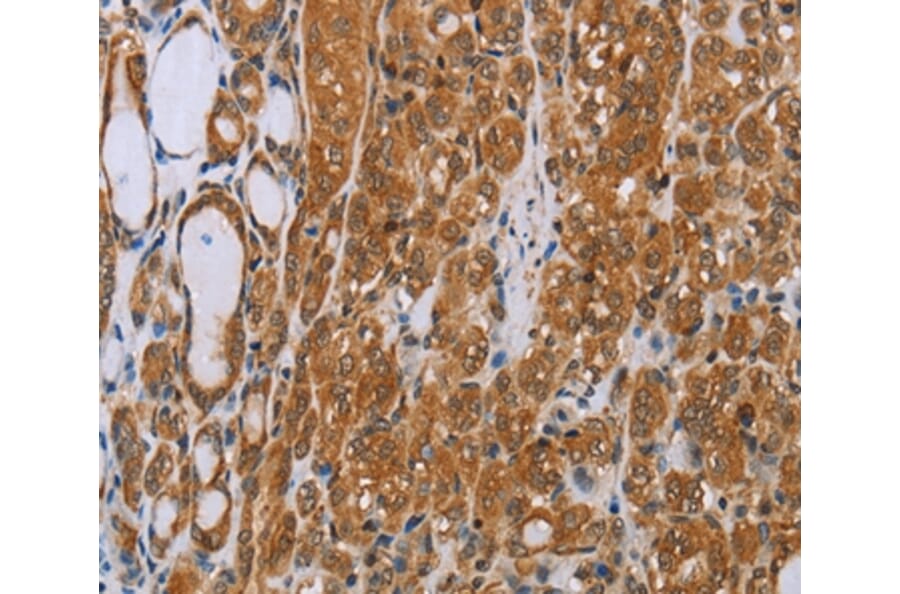 Immunohistochemistry - ADAMTS15 Antibody from Signalway Antibody (35644) - Antibodies.com