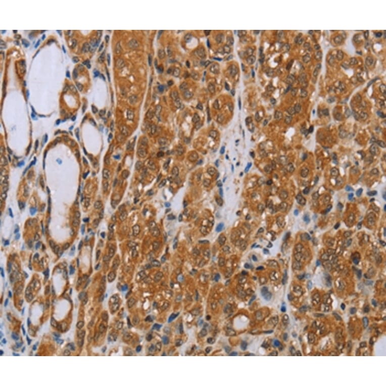 Immunohistochemistry - ADAMTS15 Antibody from Signalway Antibody (35644) - Antibodies.com