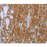 Immunohistochemistry - ADAMTS15 Antibody from Signalway Antibody (35644) - Antibodies.com