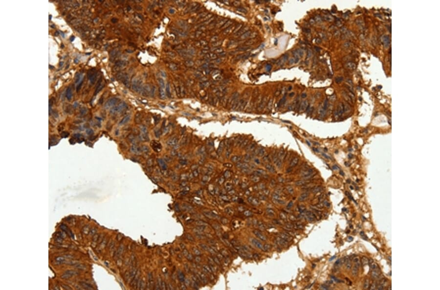 Immunohistochemistry - CEACAM21 Antibody from Signalway Antibody (35679) - Antibodies.com