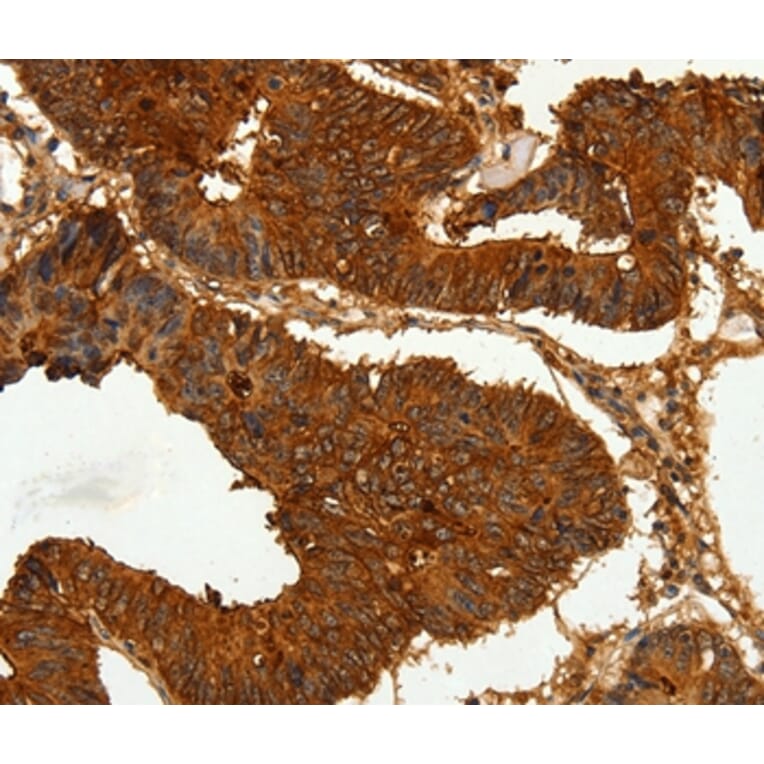 Immunohistochemistry - CEACAM21 Antibody from Signalway Antibody (35679) - Antibodies.com