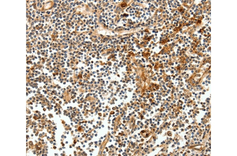 Immunohistochemistry - CEACAM21 Antibody from Signalway Antibody (35679) - Antibodies.com