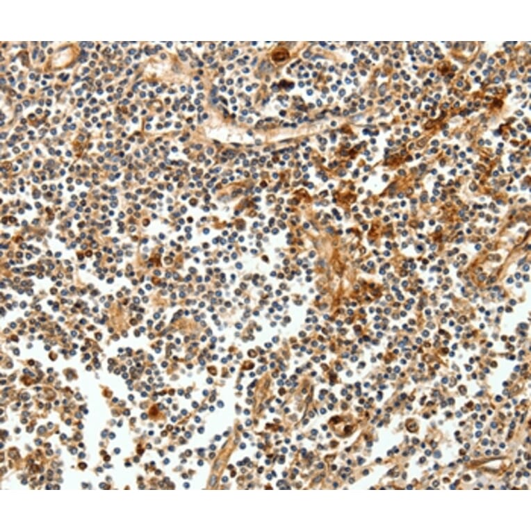 Immunohistochemistry - CEACAM21 Antibody from Signalway Antibody (35679) - Antibodies.com